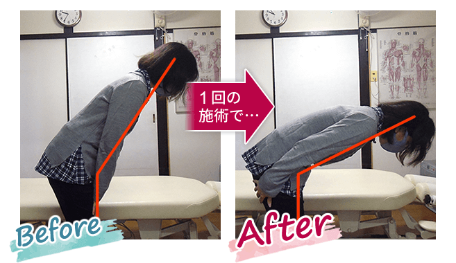 腰痛にお悩みだったK様が当院の整体を受けたBefore、After
