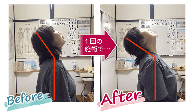 当院の整体を受けたK様のBefore、After